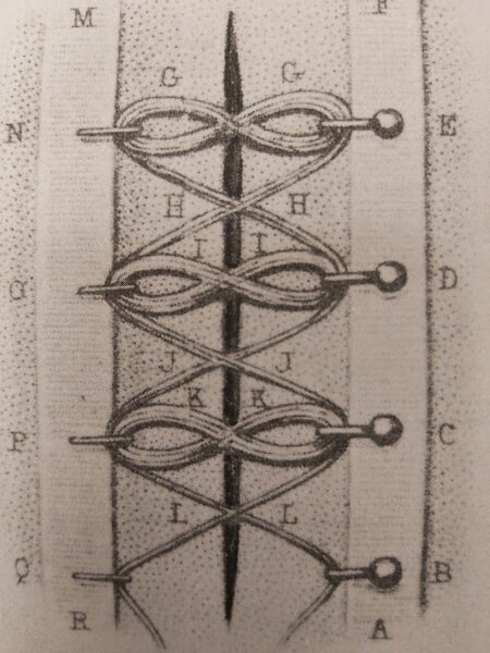 An illustrated diagram of a Roma medical procedure known as a 'fibulae' with letters set out accross it